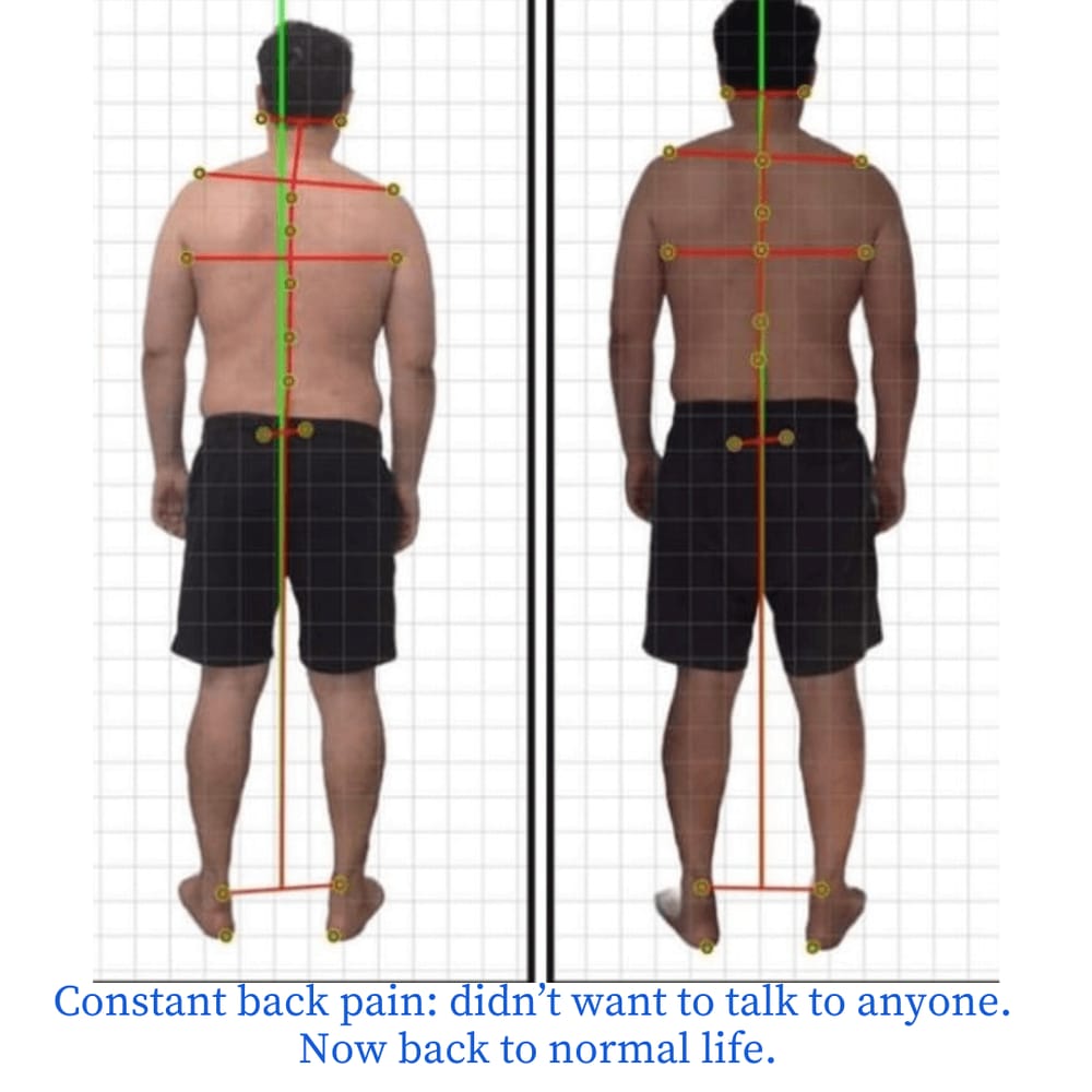 posture therapy assessment